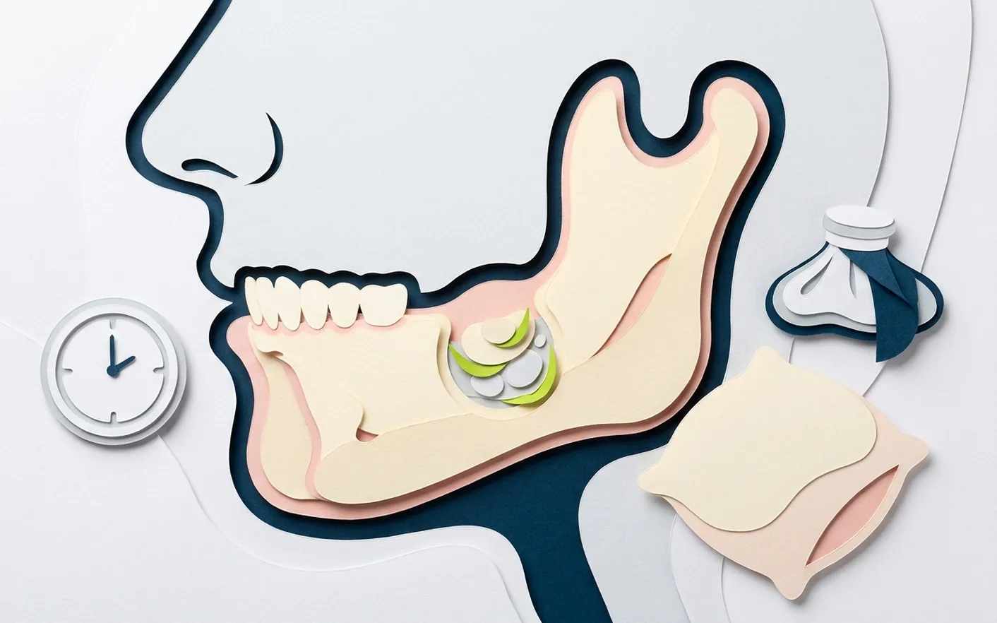 Perché si fa la TAC prima di estrarre un dente del giudizio inferiore? Foto dello studio di Via Posarelli.