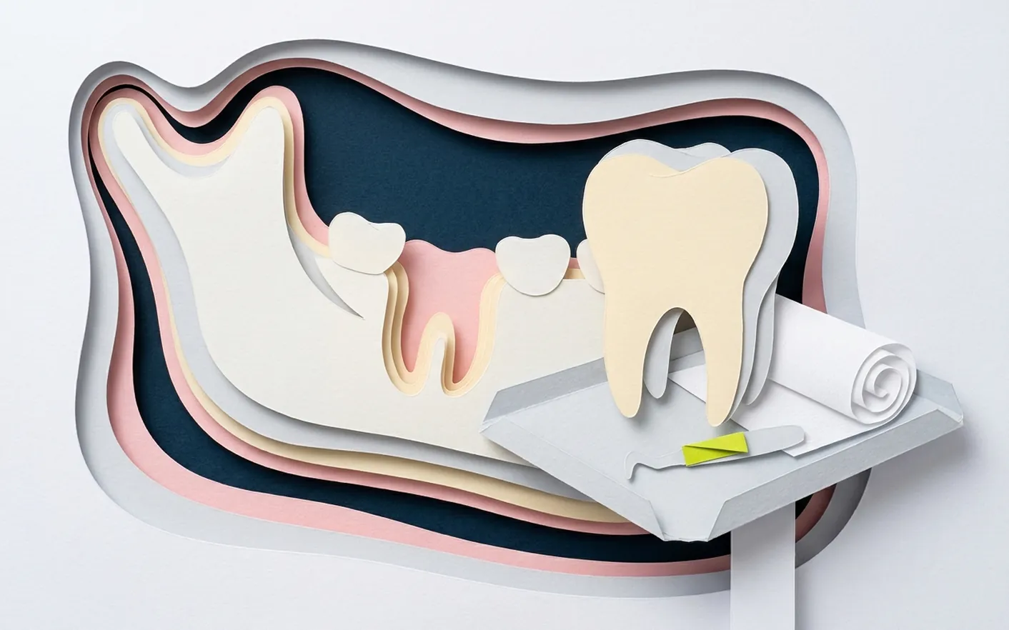 Quando un dente si toglie e quando si può ancora salvare? Foto dello studio di Via Posarelli.