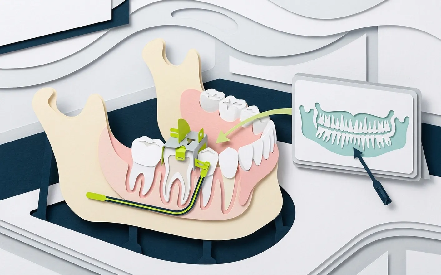 Quando si fa la panoramica dentale? Foto dello studio di Via Posarelli.