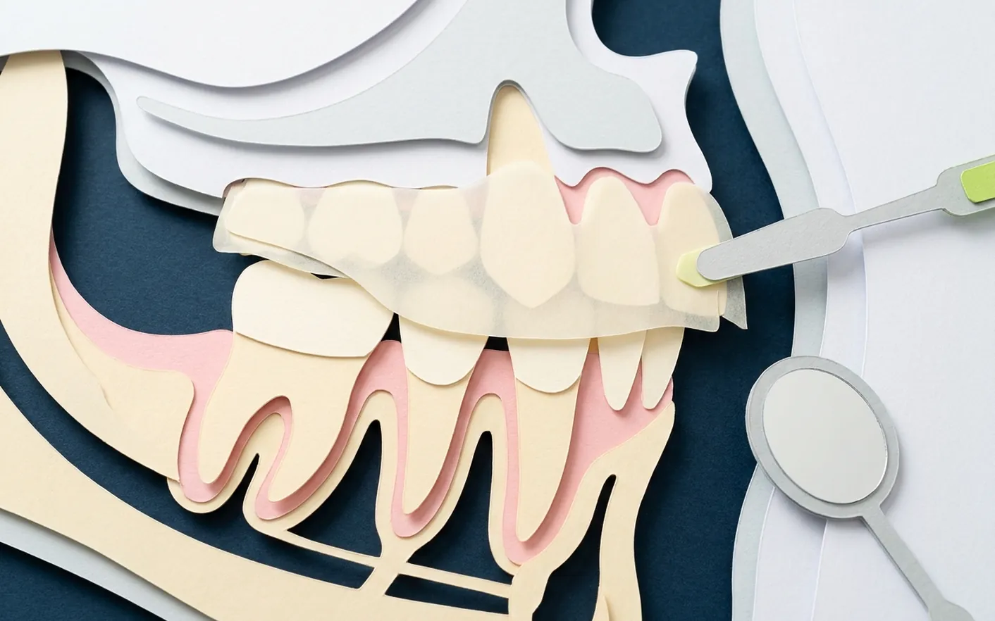 Perché prima dello sbiancamento serve la pulizia dei denti? Foto dello studio di Via Posarelli.