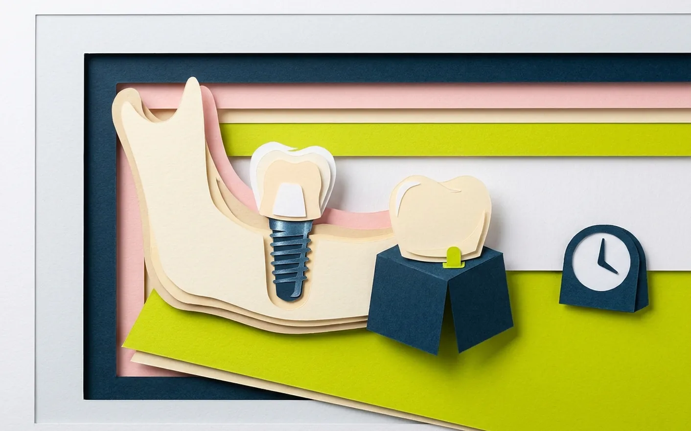 Come si svolge l'intervento per un impianto dentale? Foto dello studio di Via Posarelli.