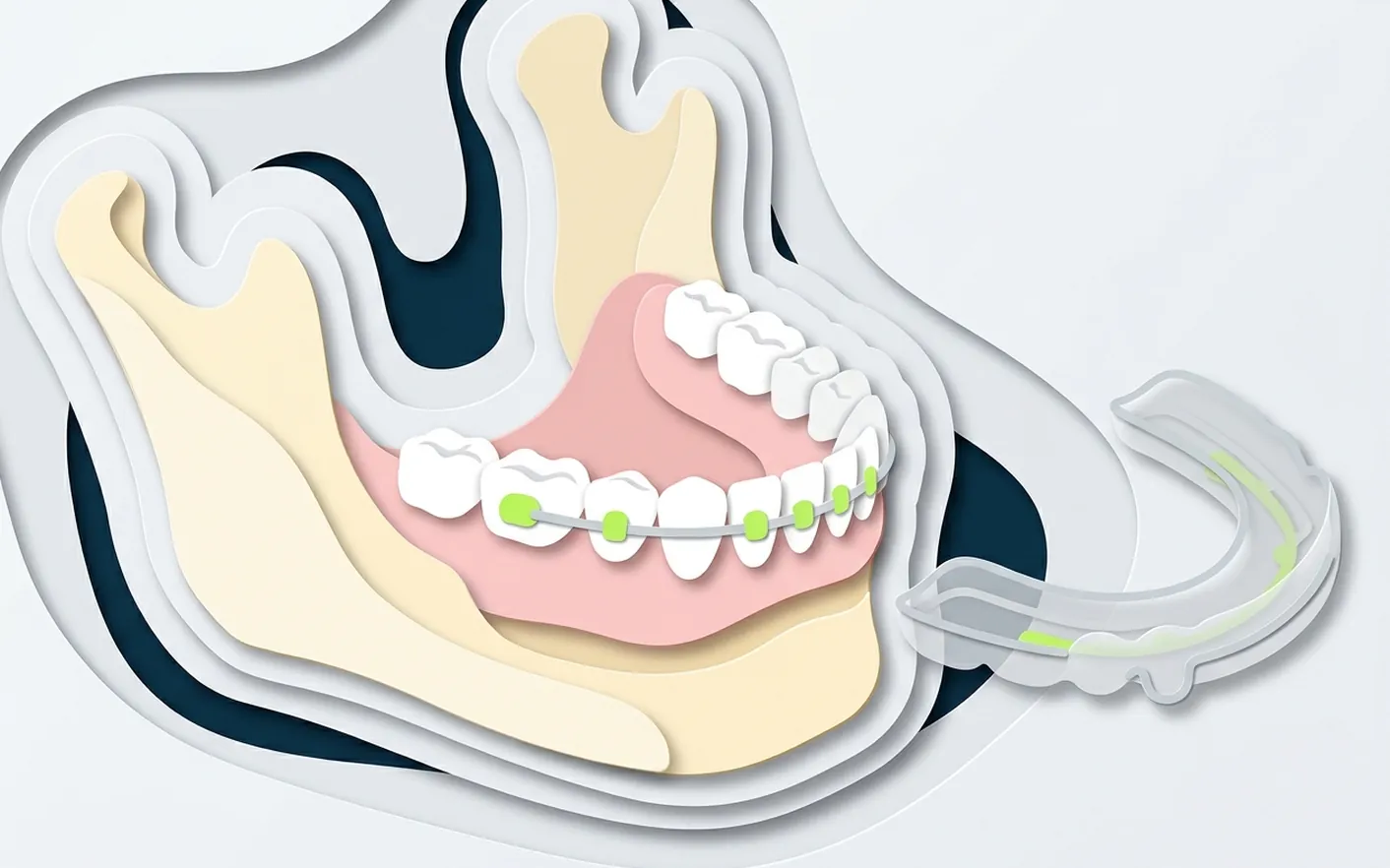 Come si svolge il trattamento con Invisalign? Foto dello studio di Via Posarelli.