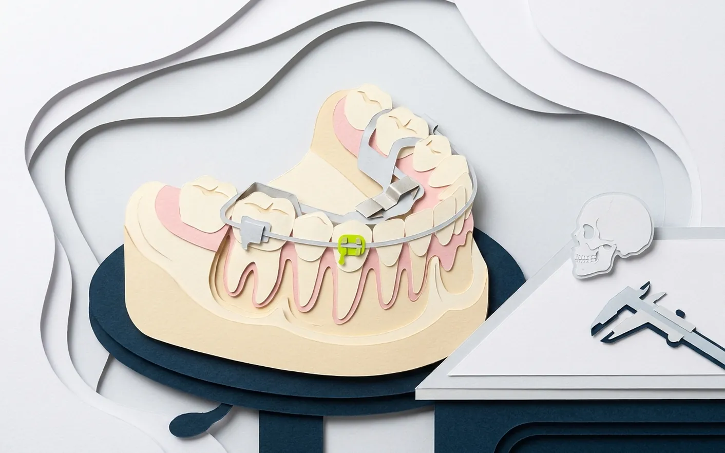 Cosa sono gli allineatori trasparenti Invisalign e come muovono i denti? Foto dello studio di Via Posarelli.