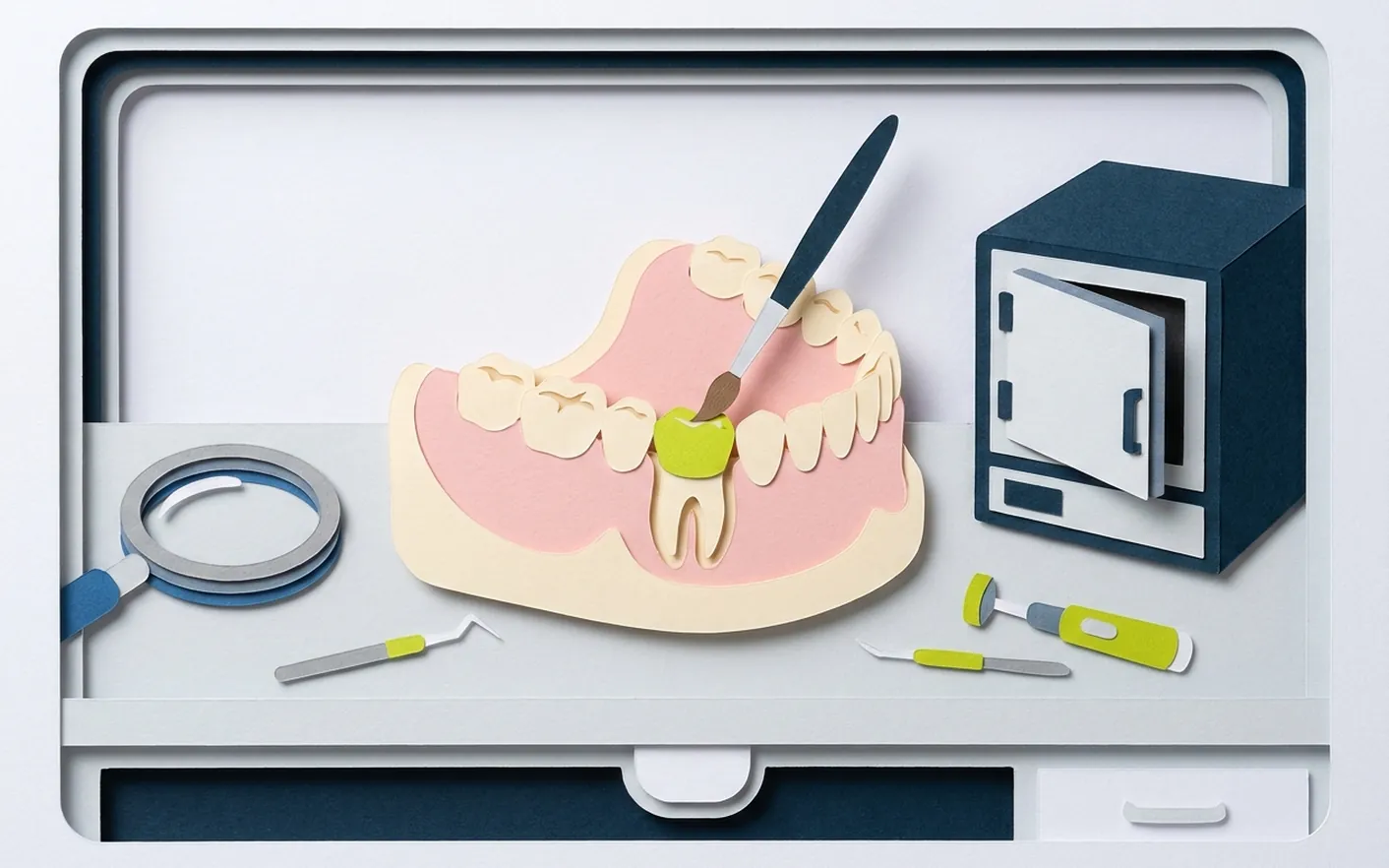 Il ponte è la scelta giusta per un dente mancante? Foto dello studio di Via Posarelli.