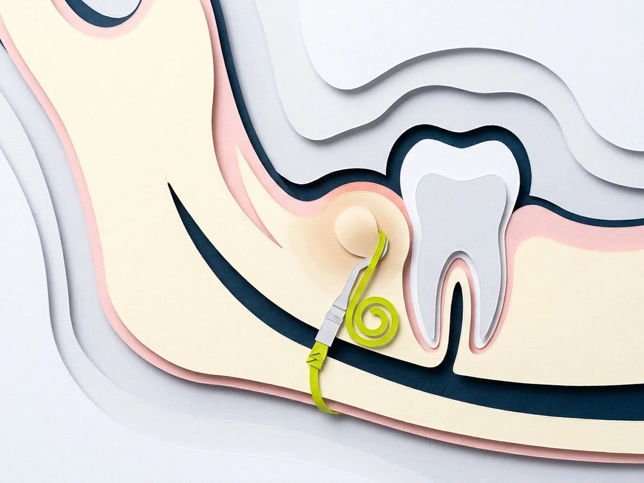 Ascesso dentale a Castelfranco di Sotto: la sala d'attesa dello studio di Via Posarelli dove si accolgono le urgenze