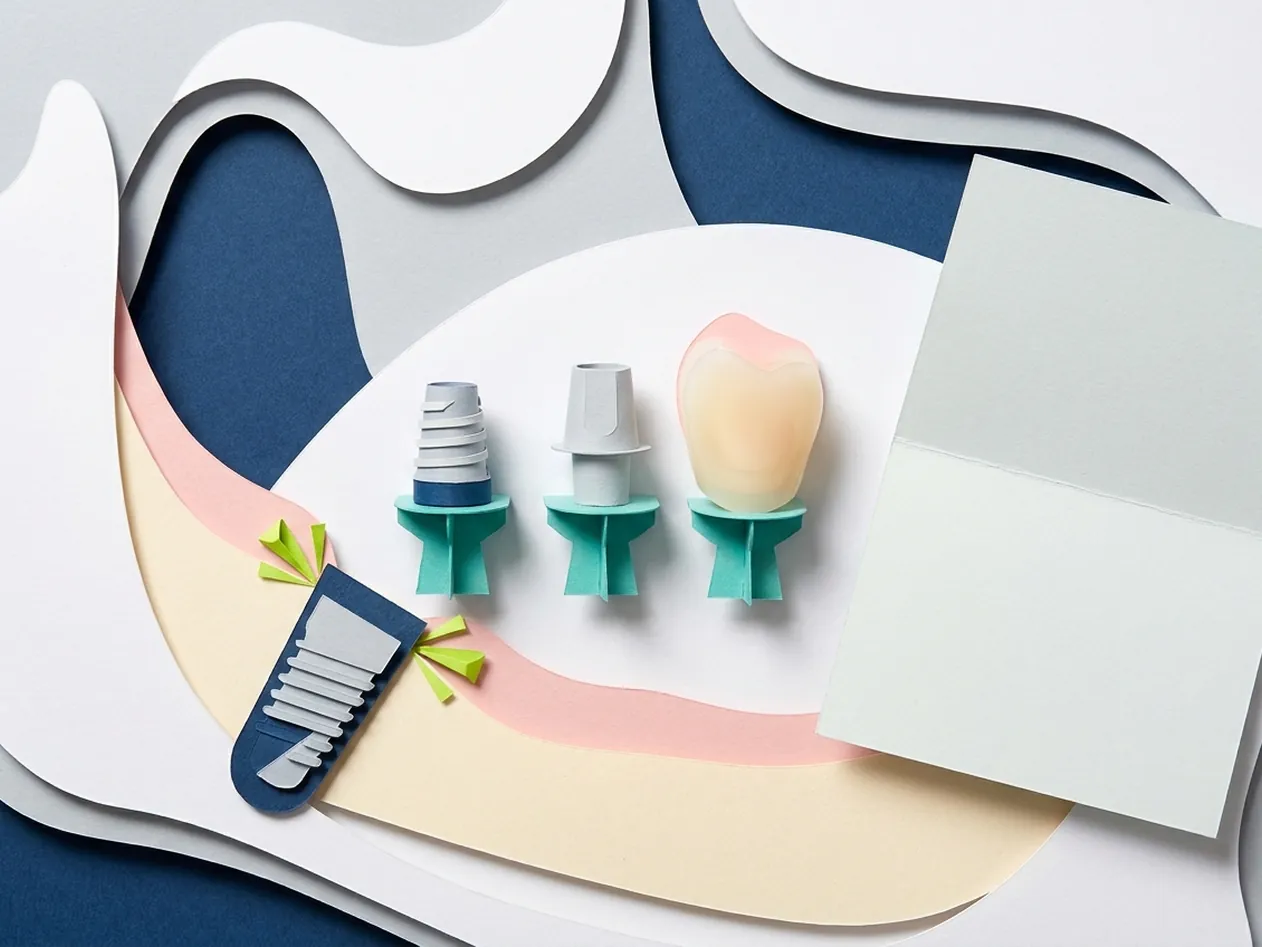 Quanto costa un impianto dentale: l'apparecchio per la TAC, prescritta quando serve, dello studio di Castelfranco di Sotto