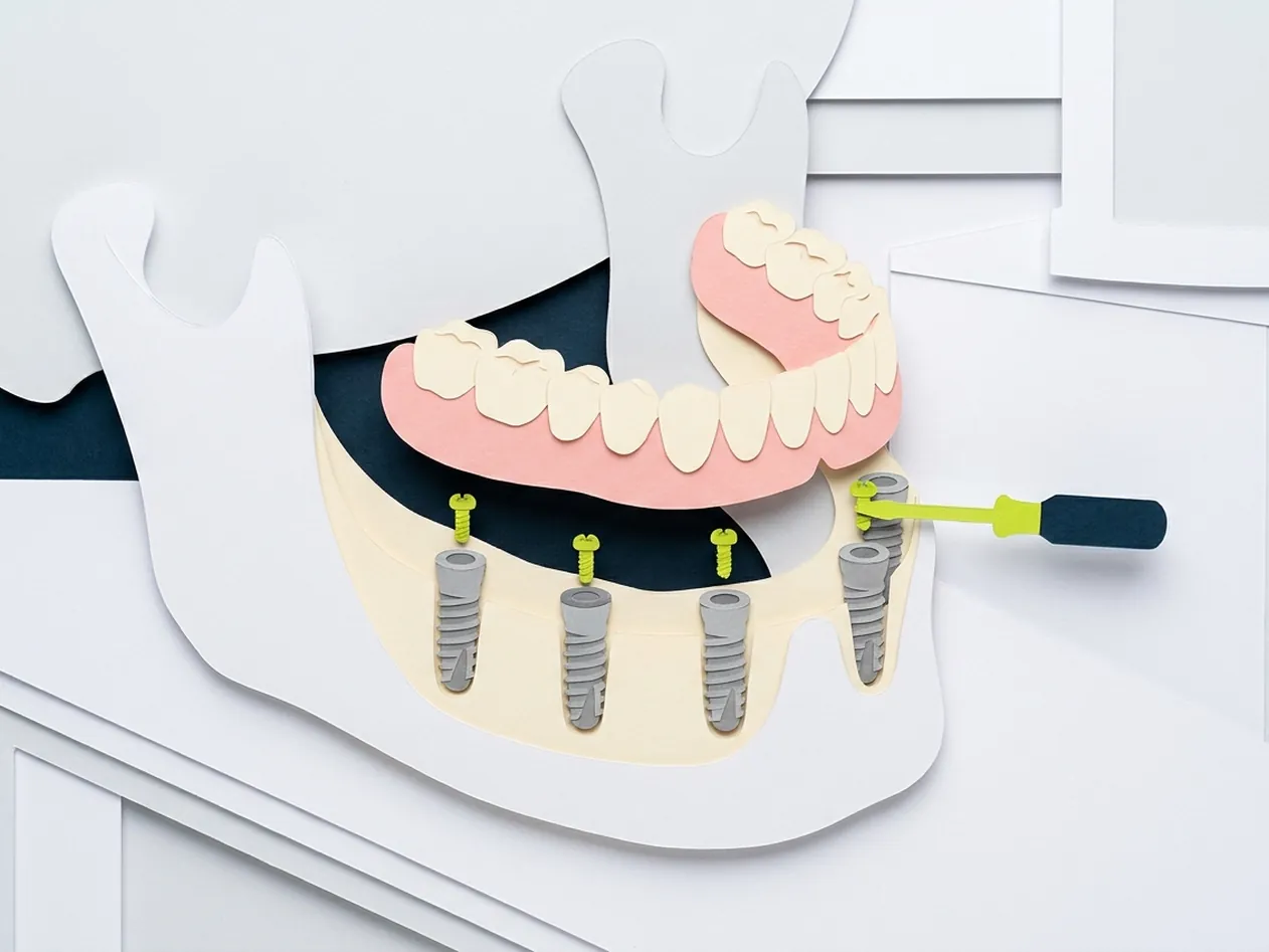 Dentiera fissa a Castelfranco di Sotto: la sala operativa dello studio di Via Posarelli