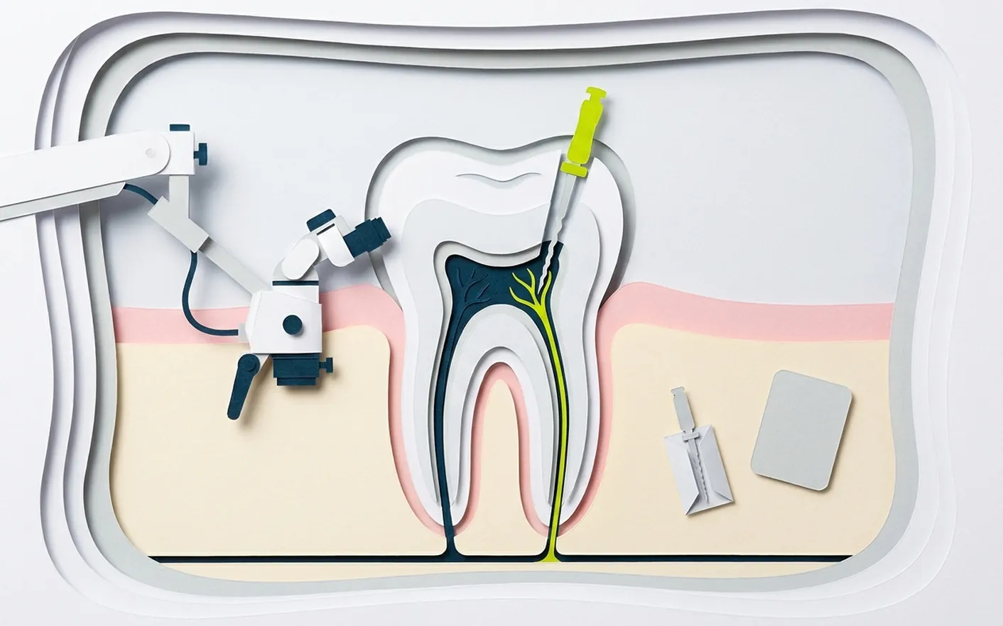 Endodonzia a Castelfranco di Sotto