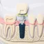 Implantologia dentale