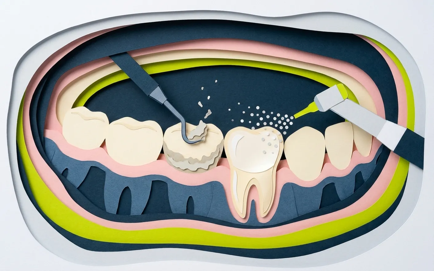 Igiene dentale e detartrasi a Castelfranco di Sotto