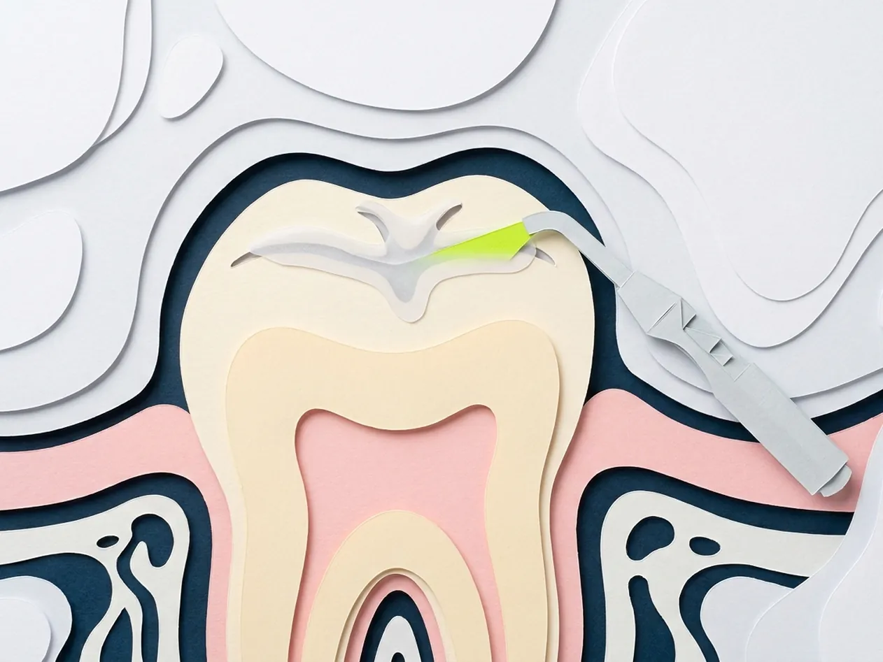 Sigillatura dei denti a Castelfranco di Sotto: la sala operativa dello studio di Via Posarelli dove si sigillano i molari dei bambini